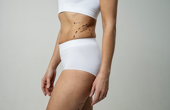 Body Lift Surgery India - Post Bariatric Skin Removal - Dr Meghna Bagalkotkar