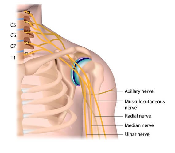 Brachial Plexus Surgery in India -Dr Meghna Bagalkotkar Brachial Plexus Surgery in India -Dr Meghna Bagalkotkar