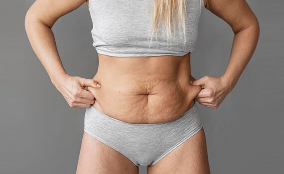 How Tuammy Tuck Surgery Is Performed - Dr Meghna Bagalkotkar