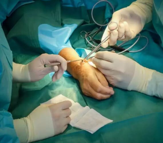 Microvascular Surgery in India - Dr Meghna Bagalkotkar