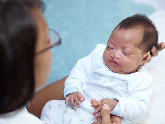 Paediatric Plastic Surgery - Dr Meghna Bagalkotkar