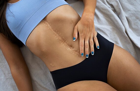 Scar Therapy in India - Dr Meghna Bagalkotkar