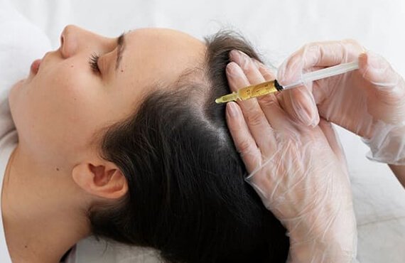 PRP Therapy - Dr Meghana Bagalkotkar